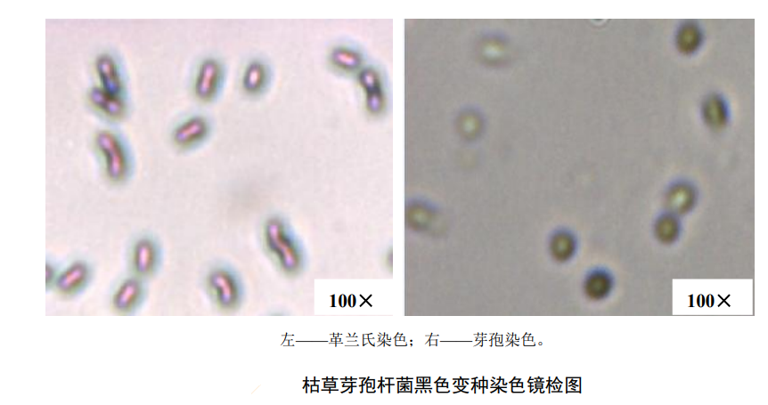 枯草芽孢杆菌黑色变种染色镜检